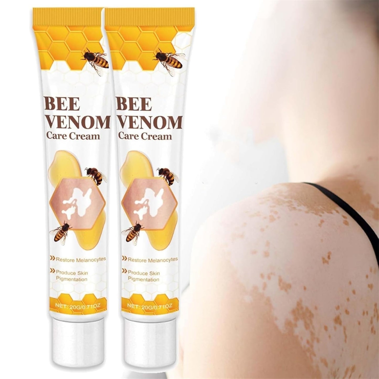 Vitigo Bee Venom Treatment Cream | Natural Skin Repair Hydration Relief Anti-Irritation